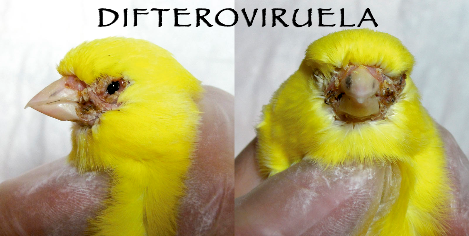 DIFTEROVIRUELA: PREVENCIÓN Y CURA